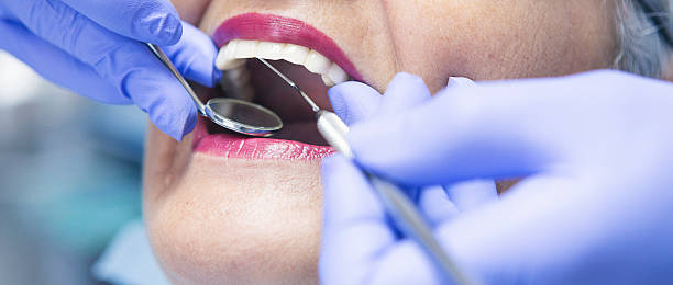 Best Emergency Wisdom Tooth Extraction in Lincoln, MT